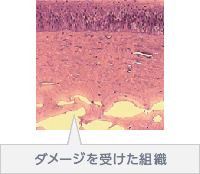 ダメージを受けた組織