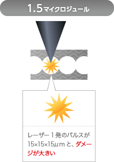 1.5マイクロジュール
