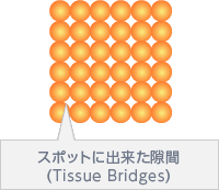 スポットにできた隙間（Tissue Bridges）