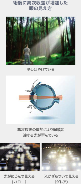 高次収差の増加により網膜に達する光が歪んでいるので少しぼやけている