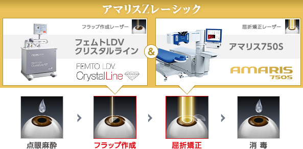 フラップ作成・屈折矯正に最高級アマリスZレーシック:フェムトLDVクリスタルライン&アマリス750S使用/アマリスZレーシック:フェトムLDV&アマリス500使用